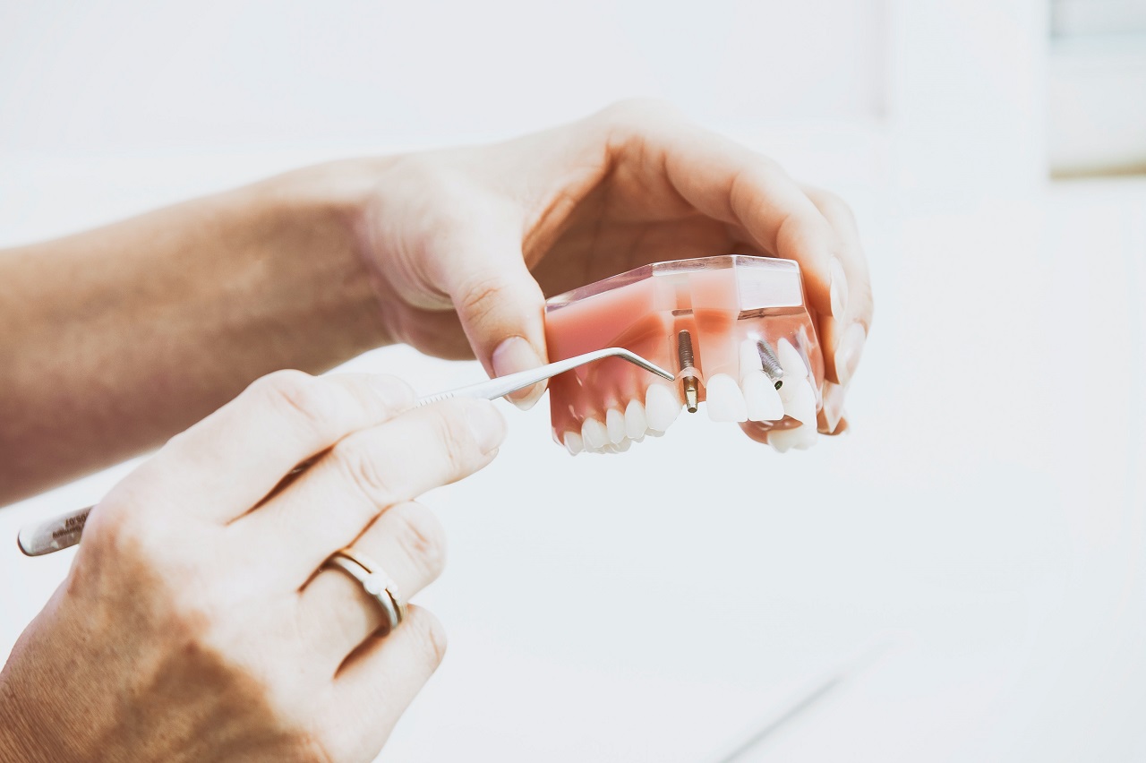 Proteza, most, implanty – czyli czym zastąpić zęby